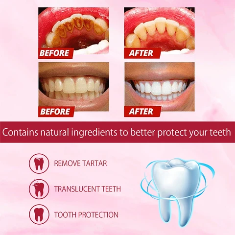 Yayashi SP-4 Probiotic Whitening & Stain Removal Toothpaste - (দাঁত হবে প্রাকৃতিকভাবে সাদা (Ultra Whitening) । ১০০% অরিজিনাল চায়না প্রোডাক্ট - Image 4