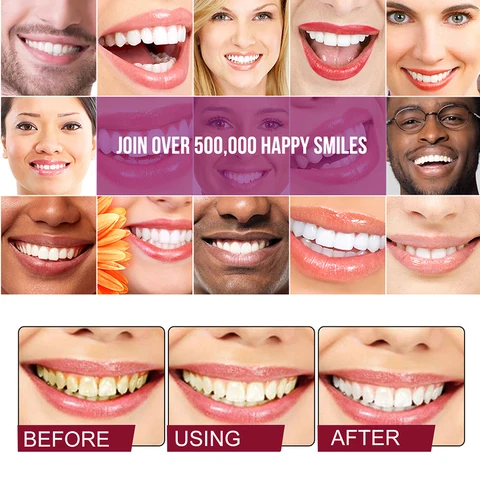 Yayashi SP-4 Probiotic Whitening & Stain Removal Toothpaste - (দাঁত হবে প্রাকৃতিকভাবে সাদা (Ultra Whitening) । ১০০% অরিজিনাল চায়না প্রোডাক্ট - Image 2