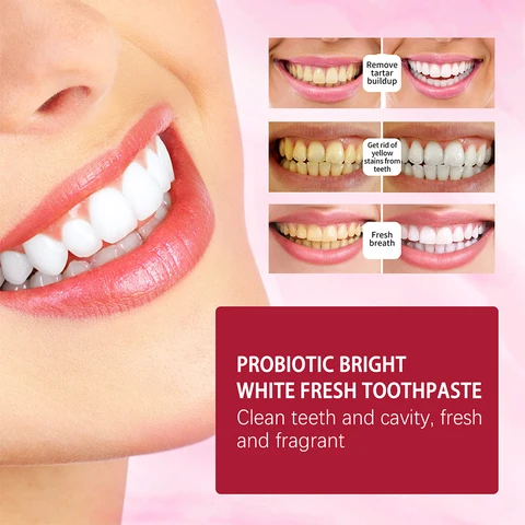 Yayashi SP-4 Probiotic Whitening & Stain Removal Toothpaste - (দাঁত হবে প্রাকৃতিকভাবে সাদা (Ultra Whitening) । ১০০% অরিজিনাল চায়না প্রোডাক্ট - Image 3